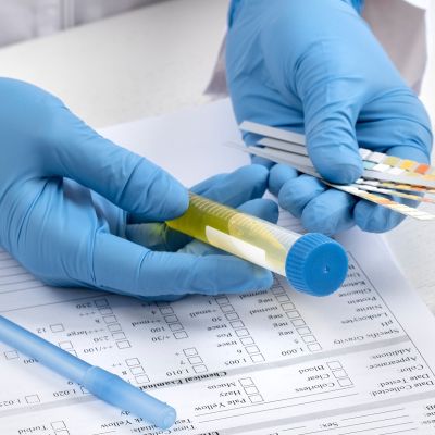 Análisis cualitativo de orina